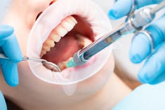 Is Pain-Free Dentistry Possible_