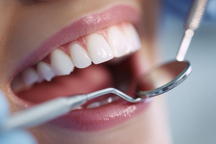 Smile Goals_ Inside the World of Dental Brilliance ✨🦷